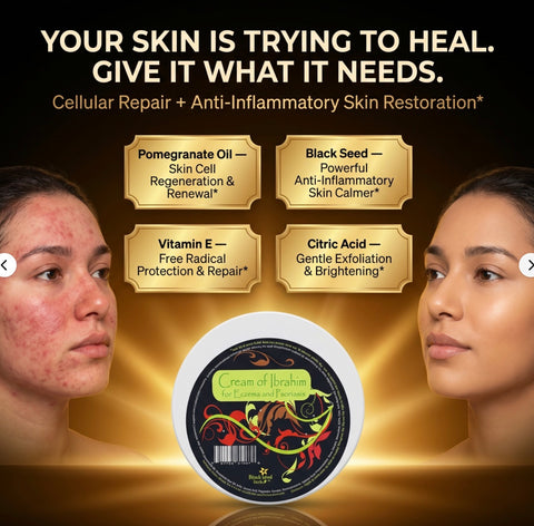 Cream Of Ibrahim (for Eczema & Psoriasis) - 5 oz