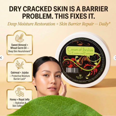 Cream Of Ibrahim (for Eczema & Psoriasis) - 5 oz